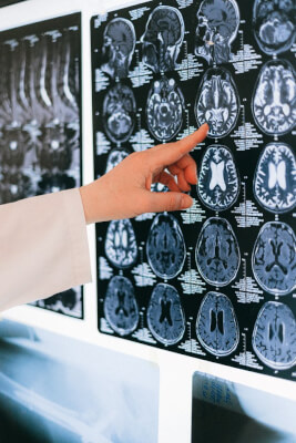 Image of medical brain scan
