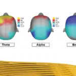 Illustration of a quantitative EEG brain map showing delta, theta, alpha, beta, and high beta brainwave activity used to support individualized Functional Neurofeedback assessment.